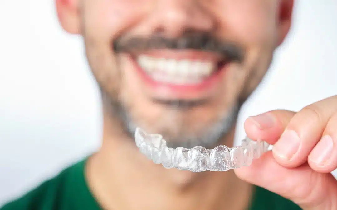 process of getting clear aligners in Greensville, SC